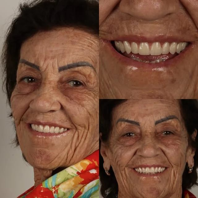 Paciente real mostrando seu sorriso após tratamento na clínica