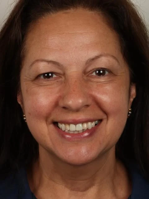 Paciente real da Sorriso Vitória sorrindo após seu tratamento